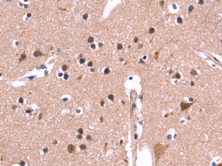 ARC Polyclonal Antibody Store at -20°C