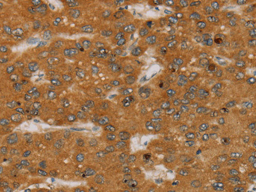 PARP3 Polyclonal Antibody Store at -20°C