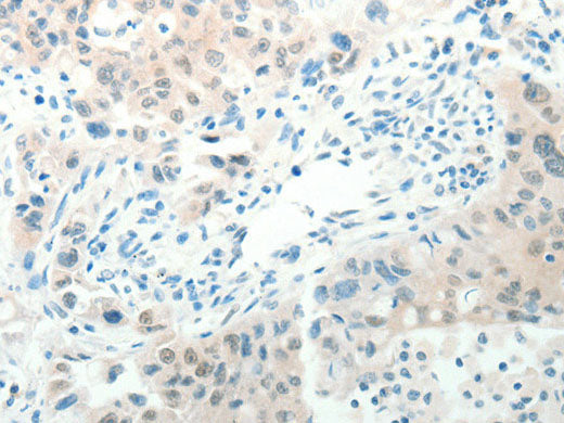 RAB25 Polyclonal Antibody Store at -20°C