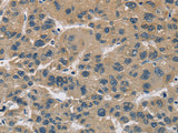CYR61 Polyclonal Antibody Store at -20°C