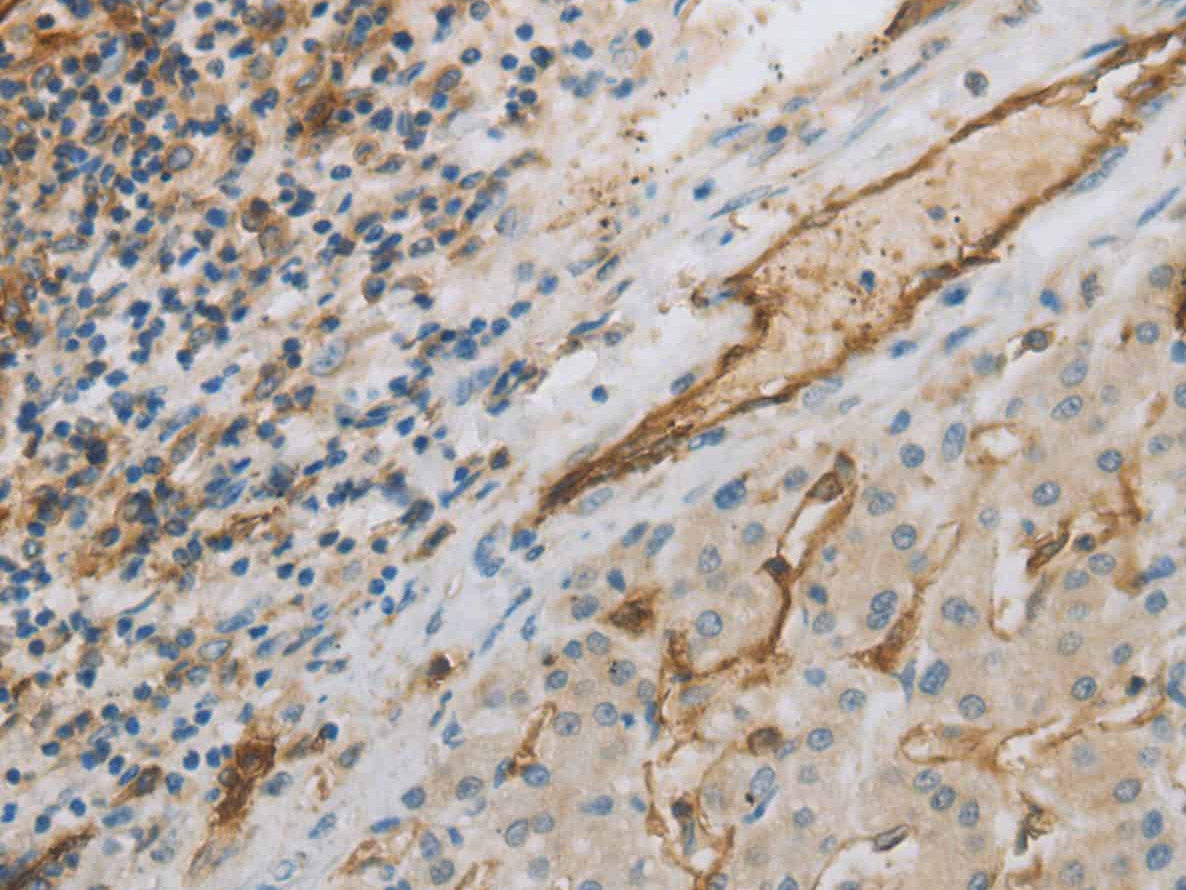 CD31 Polyclonal Antibody Store at -20°C