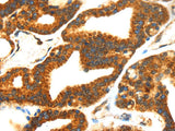 SMYD4 Polyclonal Antibody