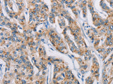 ATP2C1 Polyclonal Antibody Store at -20°C