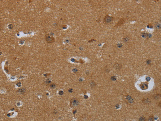ENTPD7 Polyclonal Antibody Store at -20°C