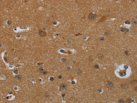 ENTPD7 Polyclonal Antibody Store at -20°C