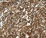 SOX-13 Polyclonal Antibody