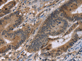 FAM107A Polyclonal Antibody Store at -20°C