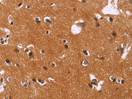CBX3 Polyclonal Antibody