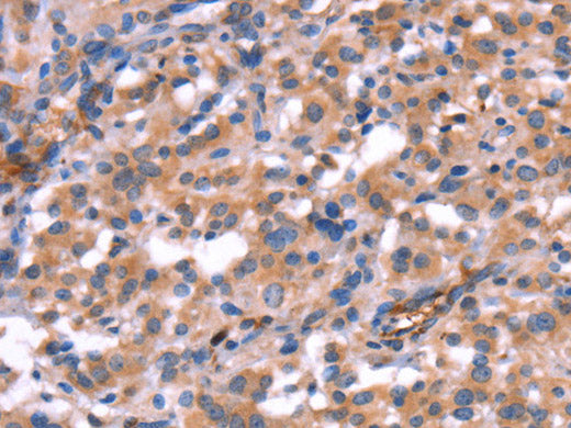 HMGCS1 Polyclonal Antibody Store at -20°C