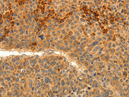 TRPM7 Polyclonal Antibody Store at -20°C
