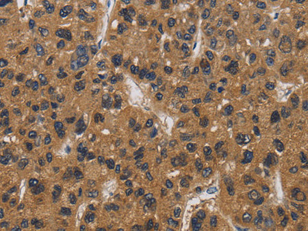 E2F4 Polyclonal Antibody Store at -20°C
