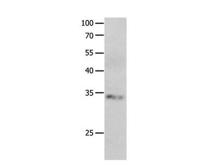 RBFOX3 Polyclonal Antibody Store at -20°C