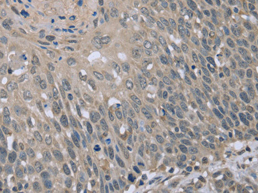 BMX Polyclonal Antibody Store at -20°C