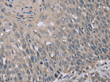 BMX Polyclonal Antibody Store at -20°C