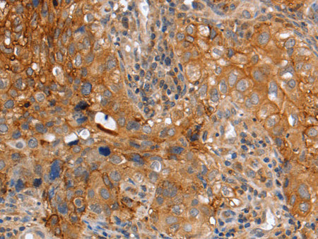 PLAUR Polyclonal Antibody Store at -20°C