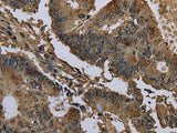 GSTO1 Polyclonal Antibody