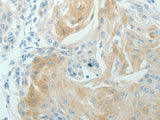 RNF126 Polyclonal Antibody Store at -20°C
