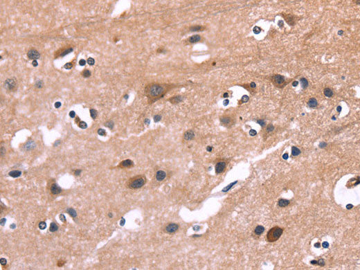 PIP5K1B Polyclonal Antibody Store at -20°C
