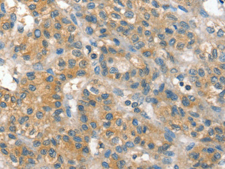 PPP2CA Polyclonal Antibody Store at -20°C