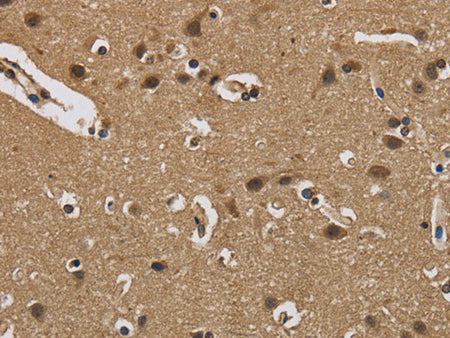 FABP2 Polyclonal Antibody Store at -20°C
