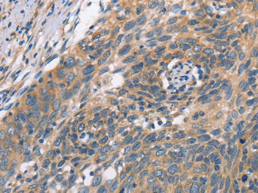 PLEKHO1 Polyclonal Antibody
