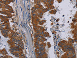NECTIN3 Polyclonal Antibody