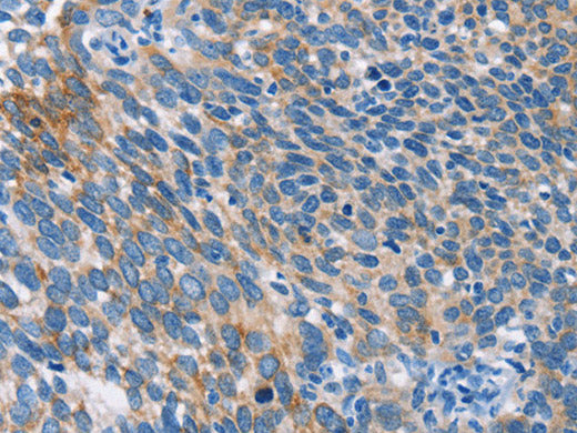 AHR Polyclonal Antibody Store at -20°C