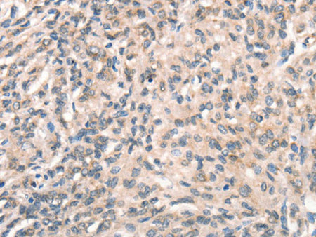 DECR1 Polyclonal Antibody Store at -20°C