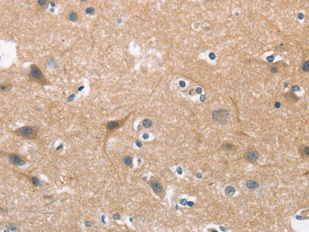 CDC25B Polyclonal Antibody Store at -20°C