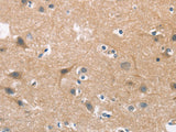 CDC25B Polyclonal Antibody Store at -20°C
