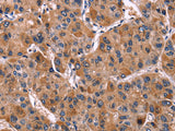 LILRB1 Polyclonal Antibody