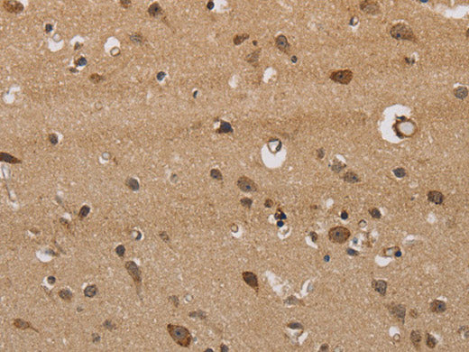 ITPR3 Polyclonal Antibody Store at -20°C