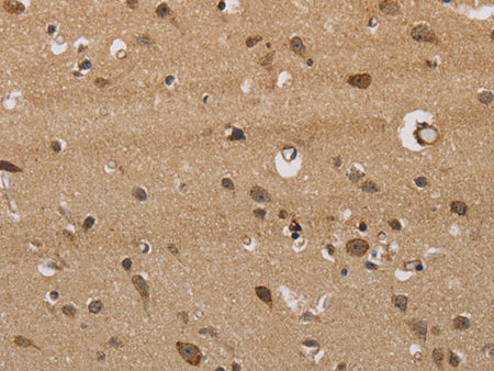 ITPR3 Polyclonal Antibody Store at -20°C