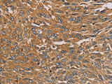 PARP11 Polyclonal Antibody