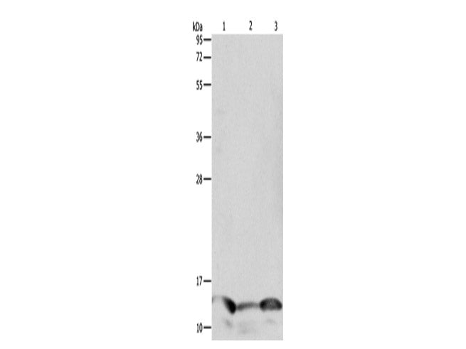 PFN1 Polyclonal Antibody Store at -20°C