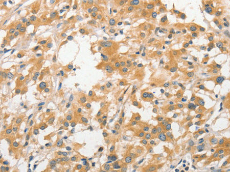 APC5 Polyclonal Antibody - MSE Supplies LLC