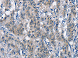 CD226 Polyclonal Antibody Store at -20°C