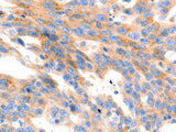 MAP2K2 Polyclonal Antibody