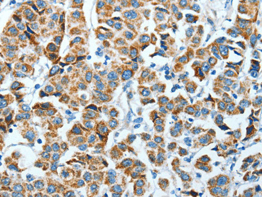 ALDH4A1 Polyclonal Antibody Store at -20°C