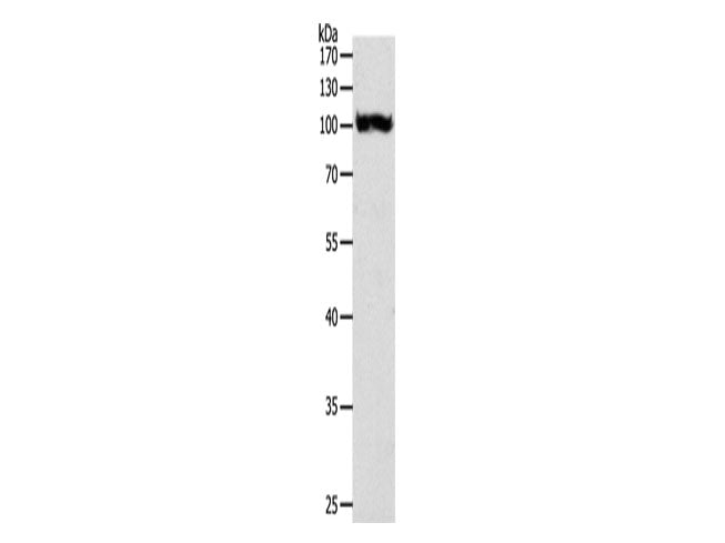 PYGB Polyclonal Antibody Store at -20°C