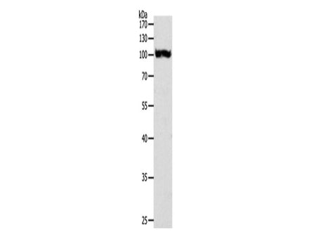 PYGB Polyclonal Antibody Store at -20°C