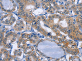 UCK1 Polyclonal Antibody