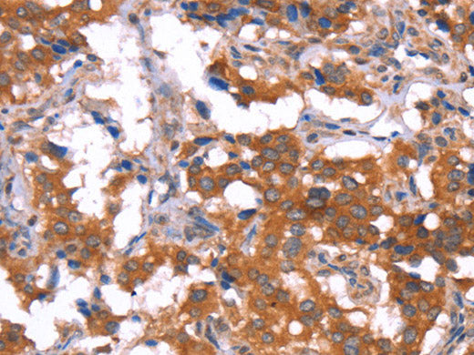 HCAR2 Polyclonal Antibody Store at -20°C