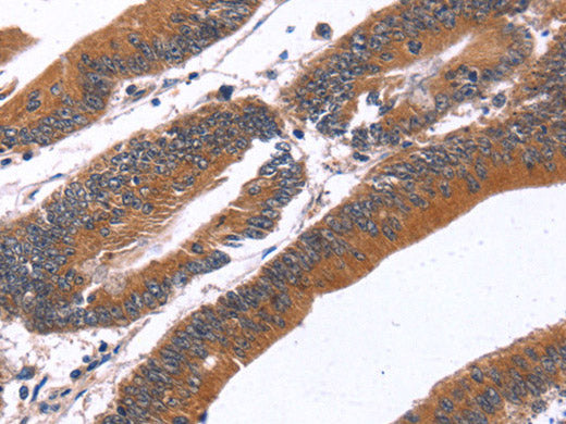 GREB1 Polyclonal Antibody Store at -20°C
