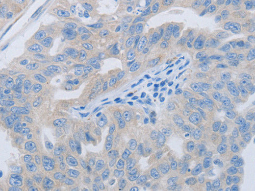 PAWR Polyclonal Antibody Store at -20°C