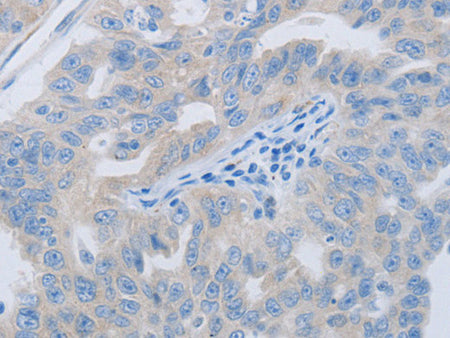 PAWR Polyclonal Antibody Store at -20°C