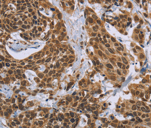 CCL21 Polyclonal Antibody Store at -20°C