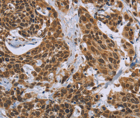CCL21 Polyclonal Antibody Store at -20°C