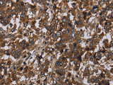 HOMER2 Polyclonal Antibody Store at -20°C