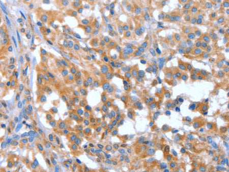NOD2 Polyclonal Antibody 	Store at -20°C